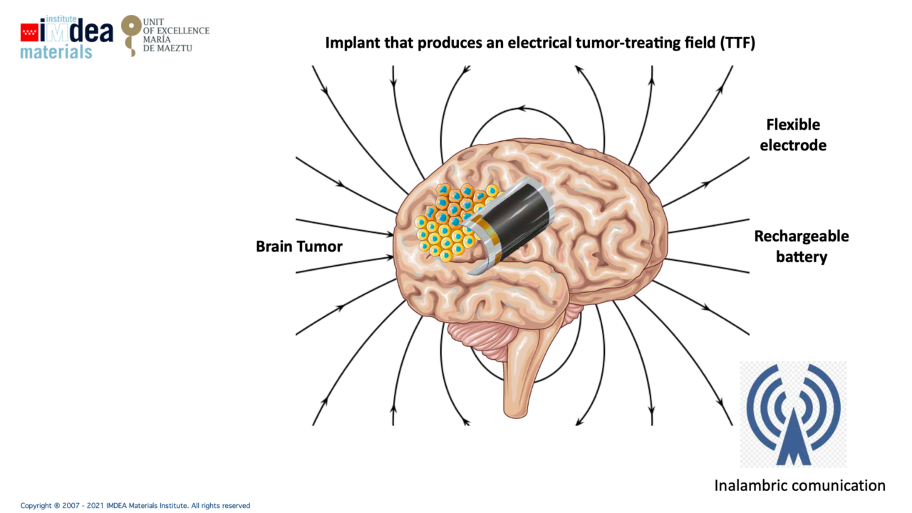Stopping brain tumor growth via electric fields using remotely powered
